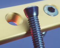 骨骼鎖定鋼板的輪廓度檢測(cè)(圖2) 骨骼鎖定鋼板的輪廓度檢測(cè)(圖2)