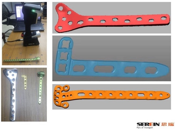 如何使用三維掃描儀進行骨骼鎖定鋼板逆向掃描(圖2) 如何使用三維掃描儀進行骨骼鎖定鋼板逆向掃描(圖2)
